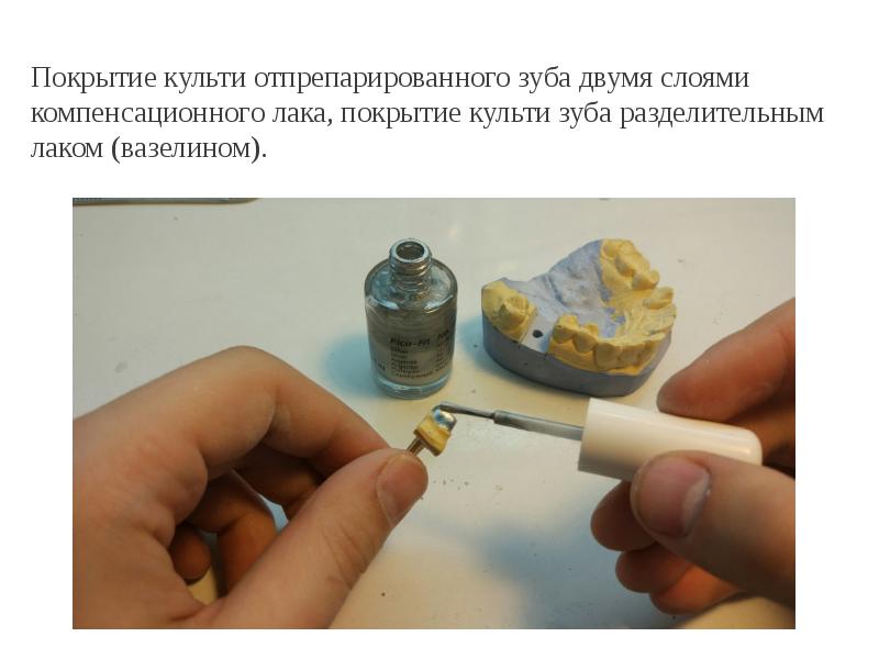 Покрытие культи отпрепарированного зуба двумя слоями компенсационного лака, покрытие культи зуба