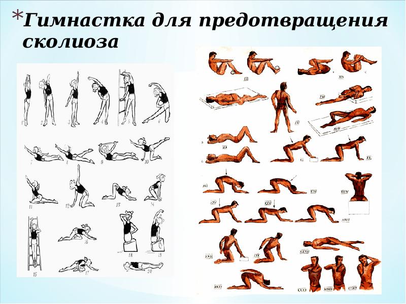 Гимнастка для предотвращения сколиоза Гимнастка для предотвращения сколиоза