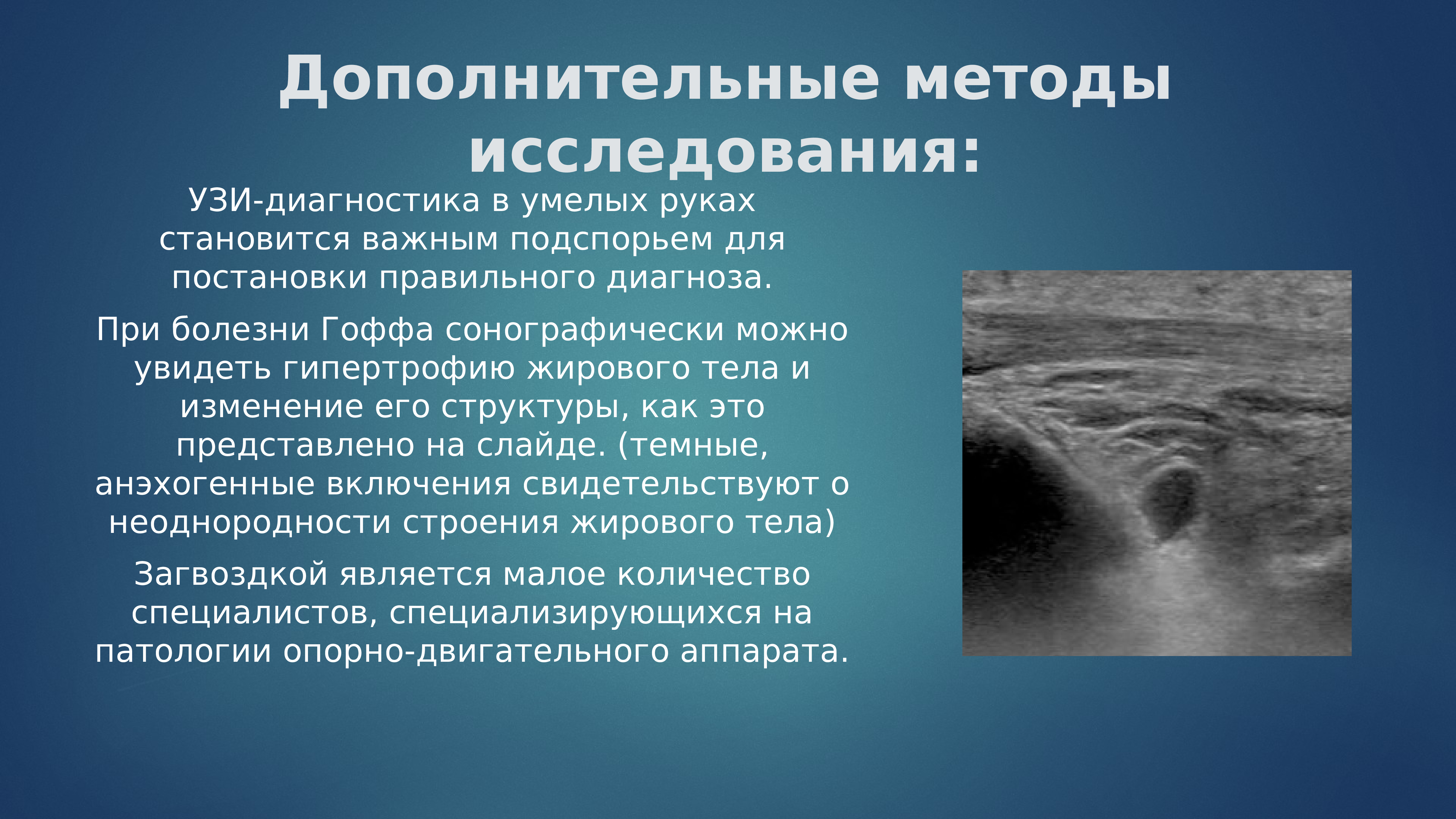 Болезнь гоффа как лечить. Болезнь гоффа как лечить