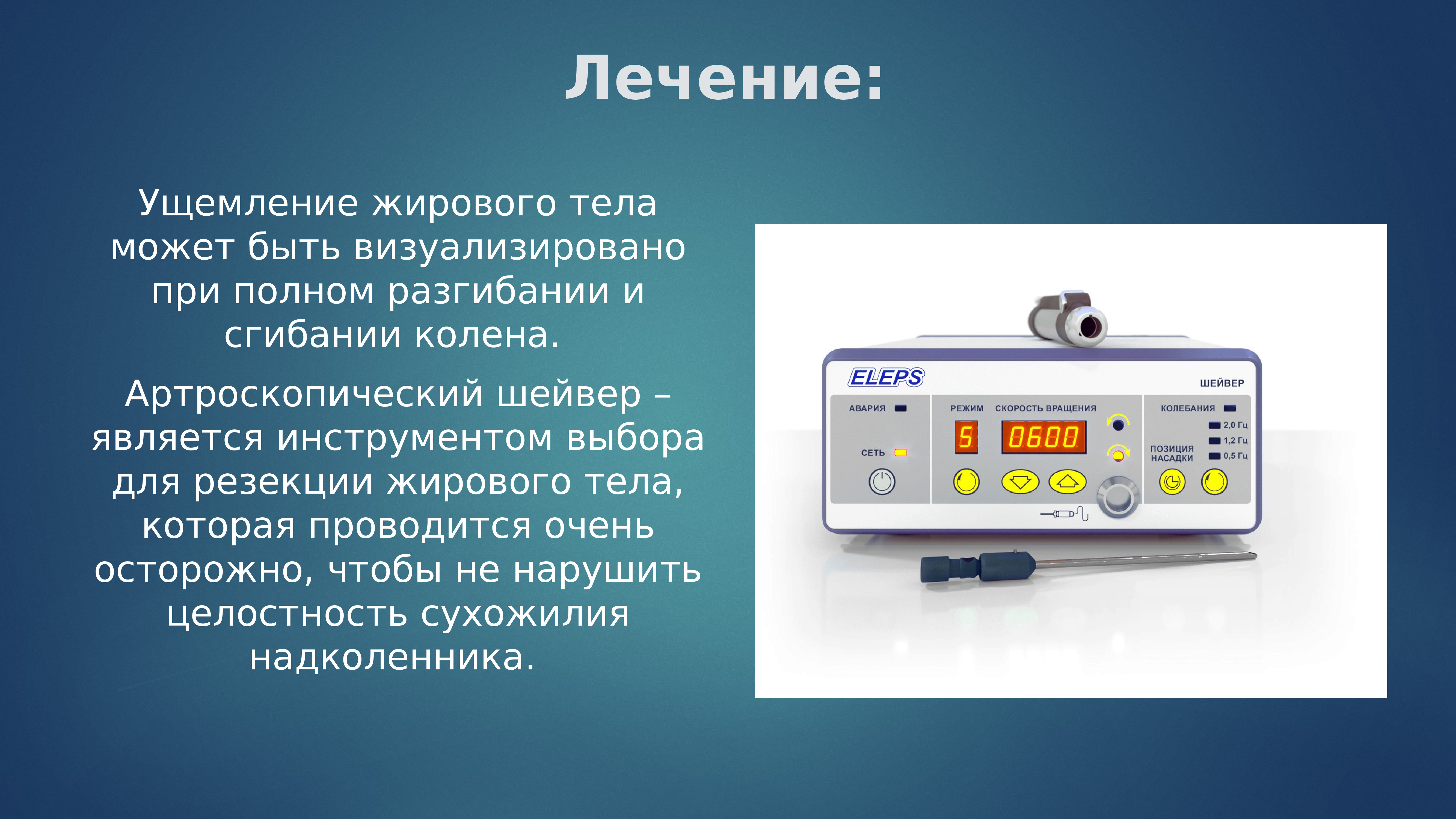 Болезнь гоффа презентация