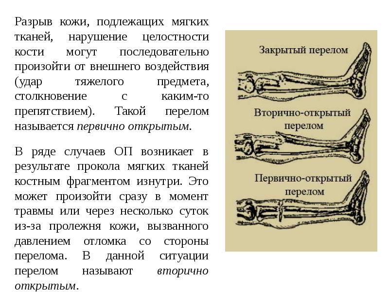 Перелом лодыжки карта вызова скорой помощи локальный статус