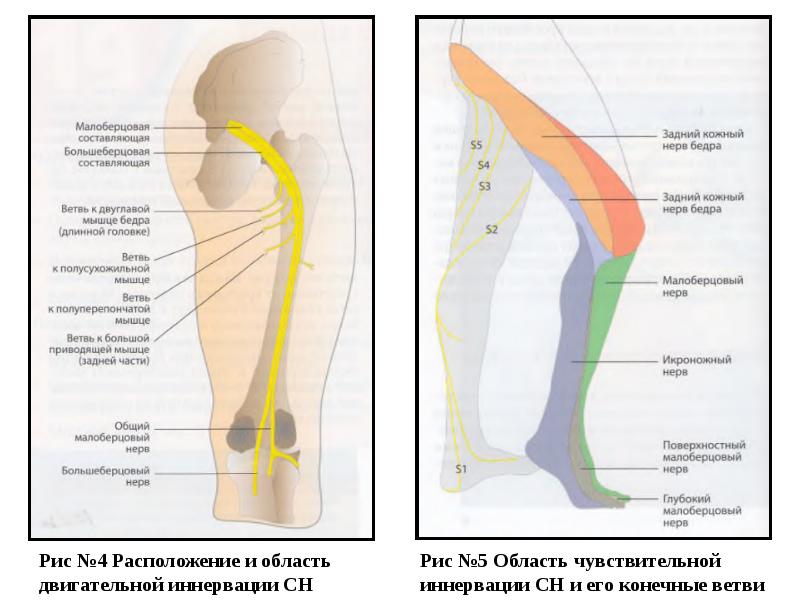 Ветви седалищного нерва схема