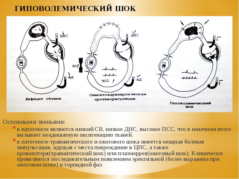 Гиповолемический шок презентация