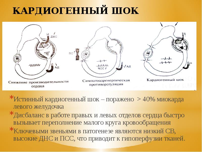 Кардиогенді шок презентация