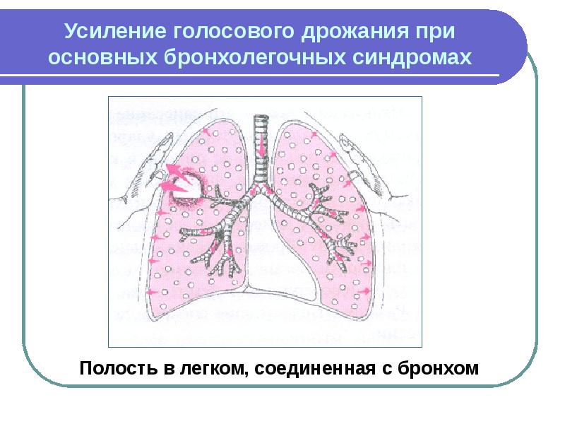 Бронхолегочные синдромы пропедевтика презентация