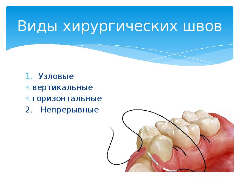 Презентация по стоматологии