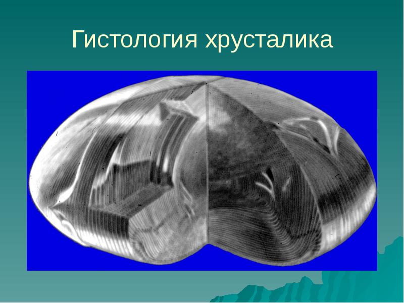 Хрусталик гистология препарат. Хрусталик гистология препарат. Хрусталик гистология. Хрусталик гистология. Строение хрусталика глаза гистология.