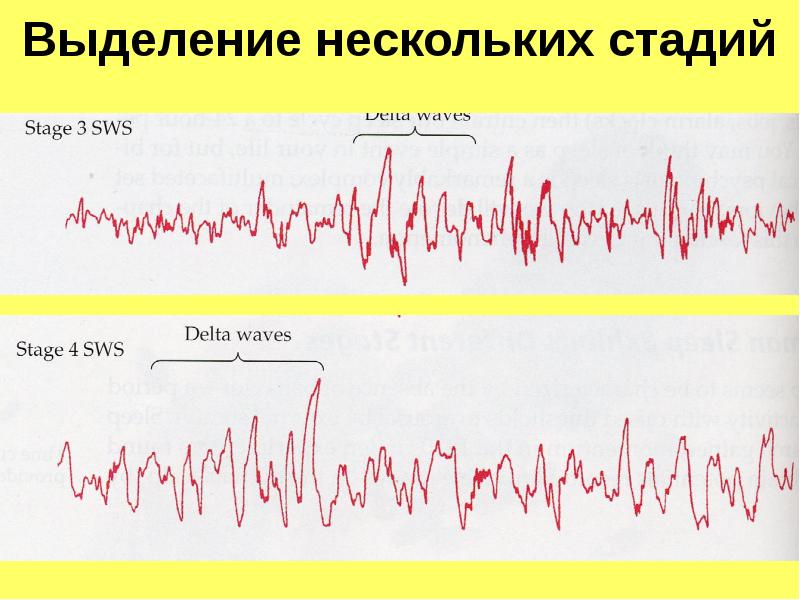 Выделение нескольких. Несколько стадий.