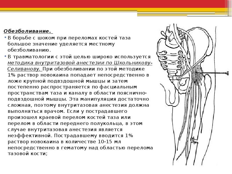 Закрытый перелом костей таза карта вызова