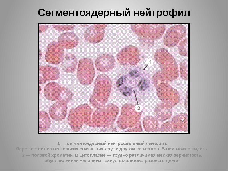 Сегментоядерные. Сегментоядерный нейтрофил зернистость. Палочкоядерный нейтрофил зернистость. Сегментоядерный гранулоцит. Препарат крови сегментоядерный нейтрофил.