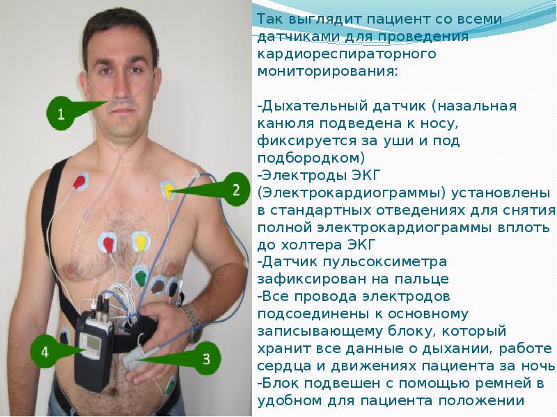 Так выглядит пациент со всеми датчиками для проведения кардиореспираторного мониторирования: Так выглядит пациент со всеми датчиками для проведения кардиореспираторного мониторирования: