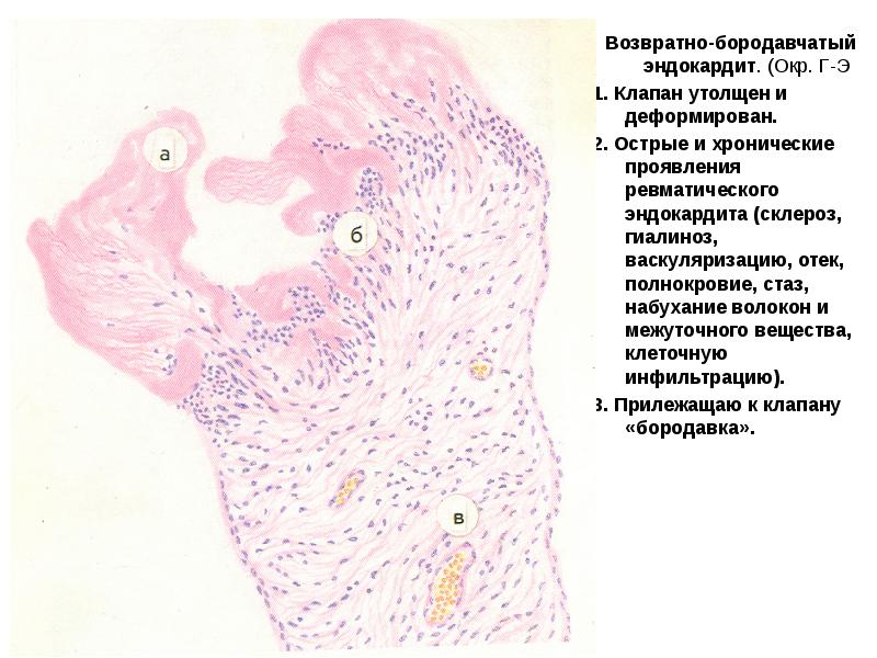 Митральный клапан гистология рисунок