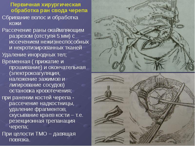 Оперативная хирургия лицевого отдела головы презентация