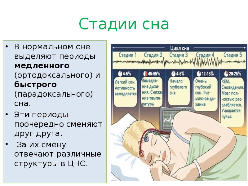 Какие этапы можно выделить во время сна. Стадии сна. Фазы сна. Сон фазы сна. Фазы сна человека физиология.