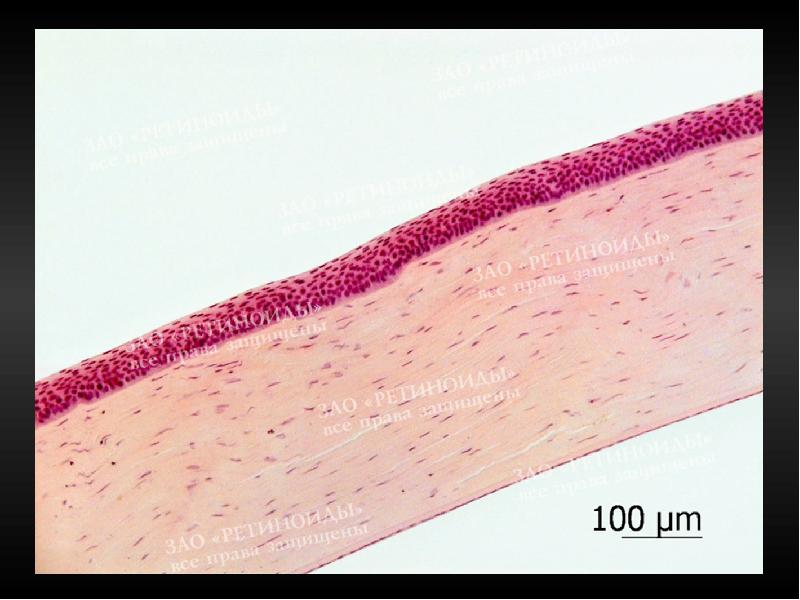 Рисунок роговицы глаза гистология