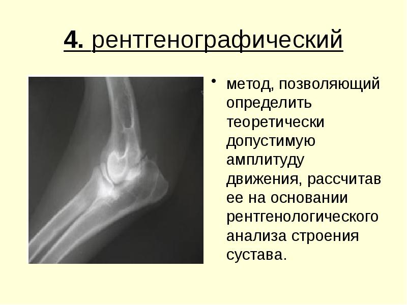 4. рентгенографический 4. рентгенографический