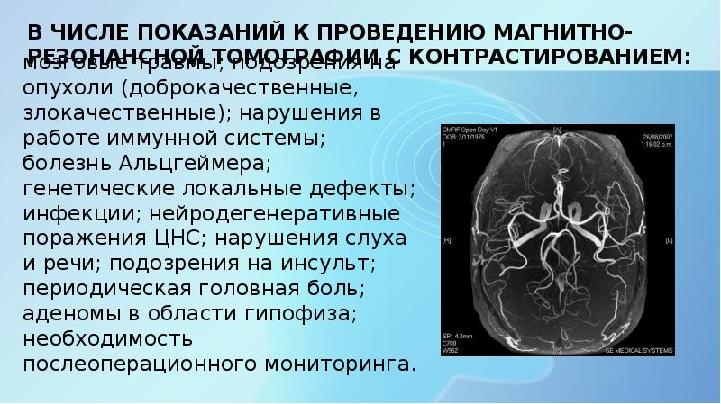 Кт с контрастом какой контраст