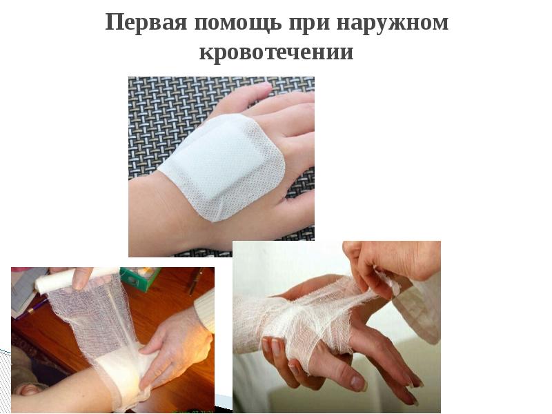 алгоритм оказания первой помощи при наружном кровотечении. 1 помощь при кровотечении кратко. оказание первой доврачебной помощи при кровотечениях. первая помощь при наложении жгута при кровотечениях. правила оказания первой помощи при кровотечении.