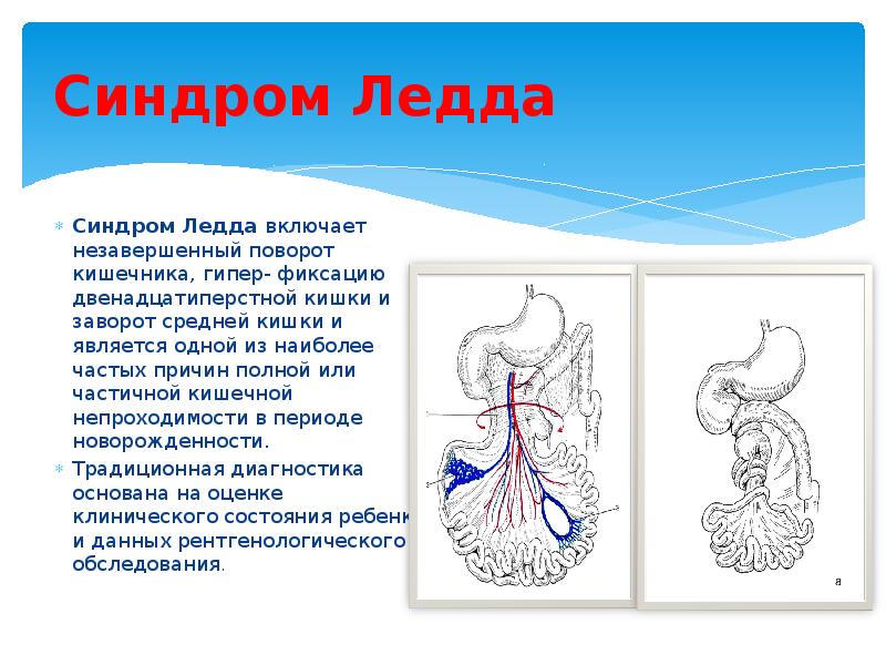 Синдромы жкт презентация