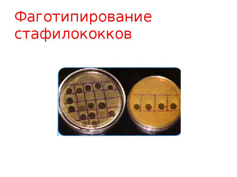 Фаготипирование это. Фаготипирование культуры стафилококка. фаготипирование стафилококков микробиология. фаготипирование бактериофагов. фаготипирование применяется для.