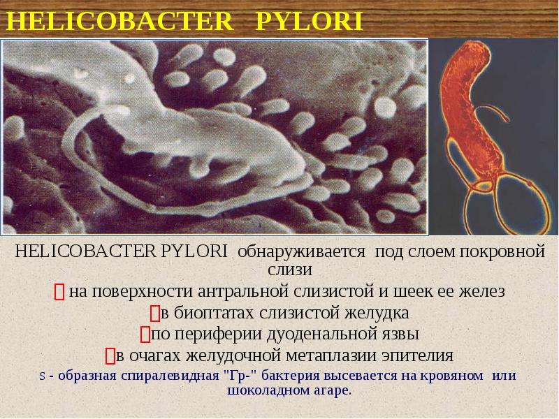 Определение хеликобактер в кале. Биопсия хеликобактер пилори. Хеликобактер пилори в слизистой. Хеликобактер пилори в желудке.