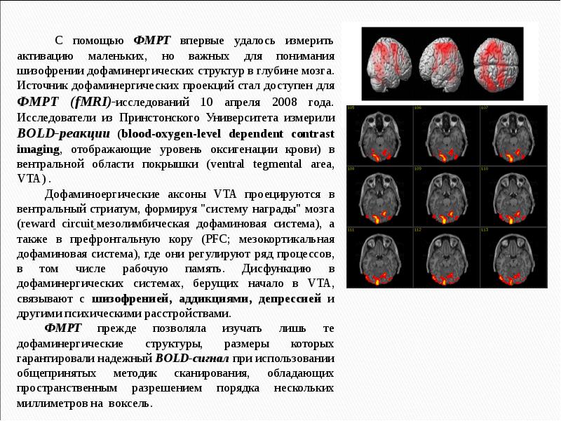 Функциональная мрт презентация