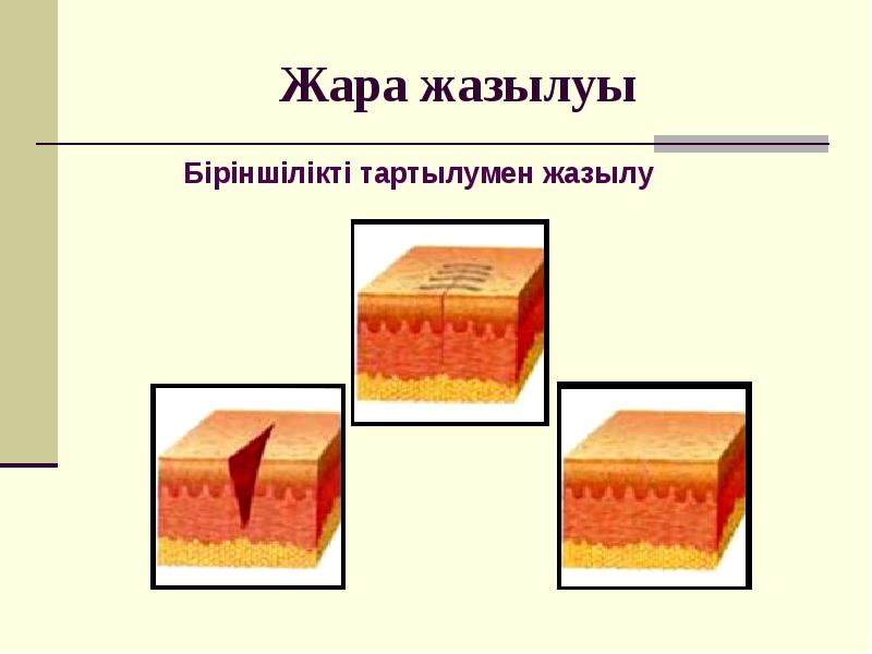 Аитв инфекциясы презентация