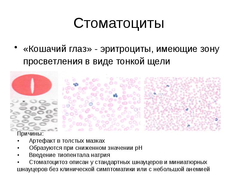 Эритроциты имеют непостоянную форму