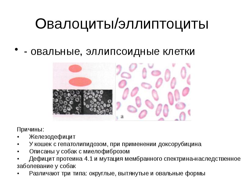 Овалоциты/эллиптоциты
- овальные, эллипсоидные клетки Овалоциты/эллиптоциты
- овальные, эллипсоидные клетки