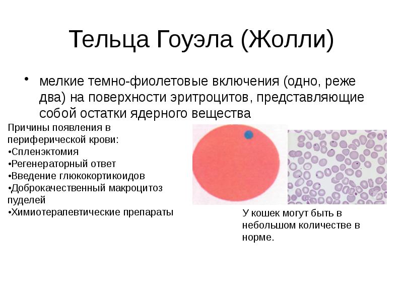 Тельца Гоуэла (Жолли)
мелкие темно-фиолетовые включения (одно, реже два) на поверхности Тельца Гоуэла (Жолли)
мелкие темно-фиолетовые включения (одно, реже два) на поверхности