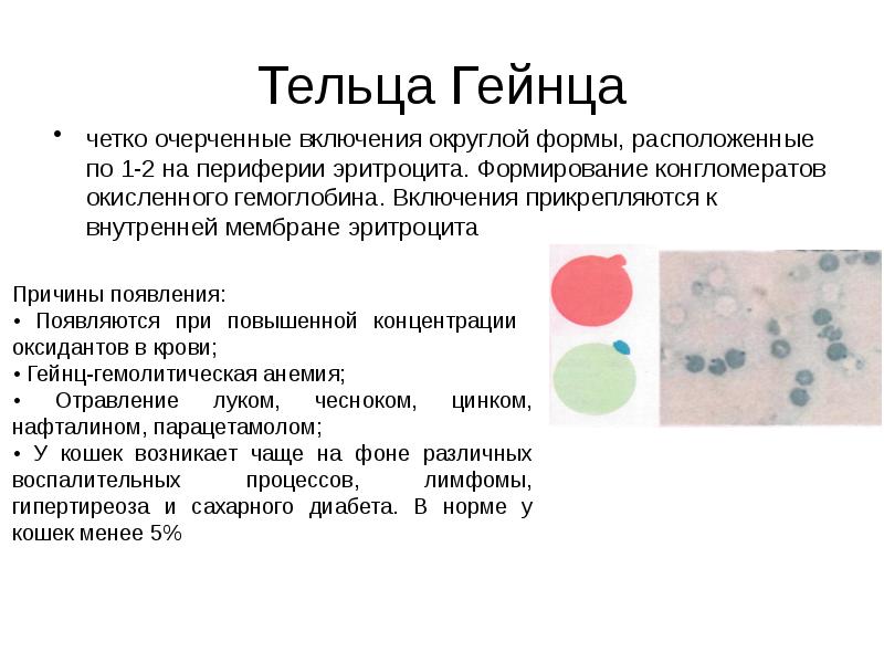 Тельца Гейнца
четко очерченные включения округлой формы, расположенные по 1-2 на Тельца Гейнца
четко очерченные включения округлой формы, расположенные по 1-2 на