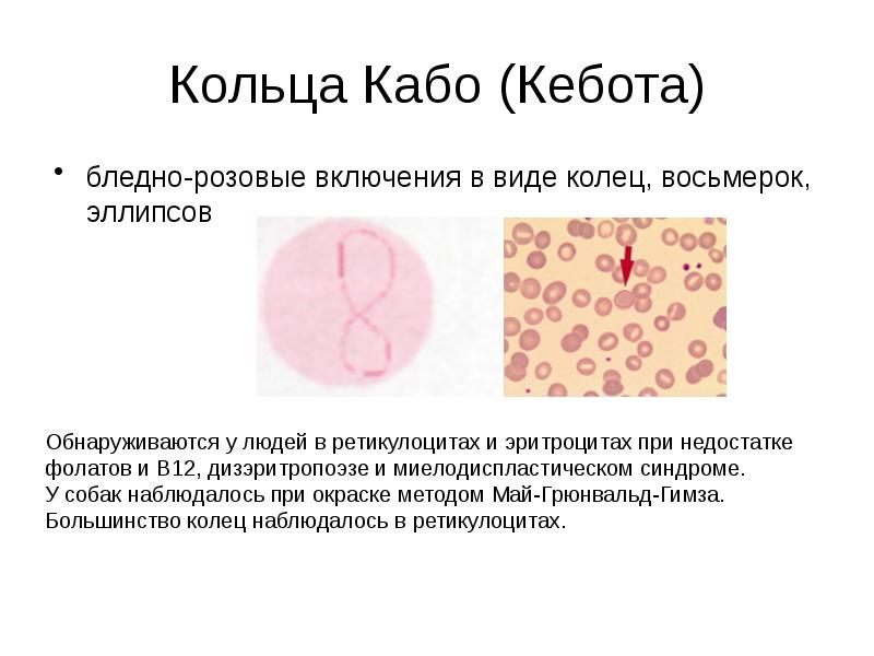 Кольца Кабо (Кебота)
бледно-розовые включения в виде колец, восьмерок, эллипсов Кольца Кабо (Кебота)
бледно-розовые включения в виде колец, восьмерок, эллипсов