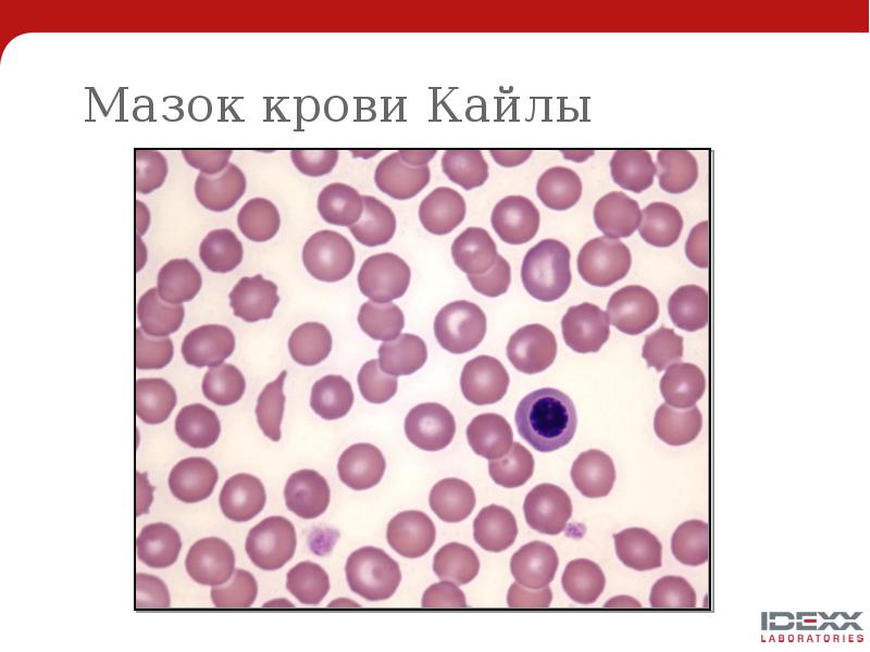 Мазок крови Кайлы Мазок крови Кайлы