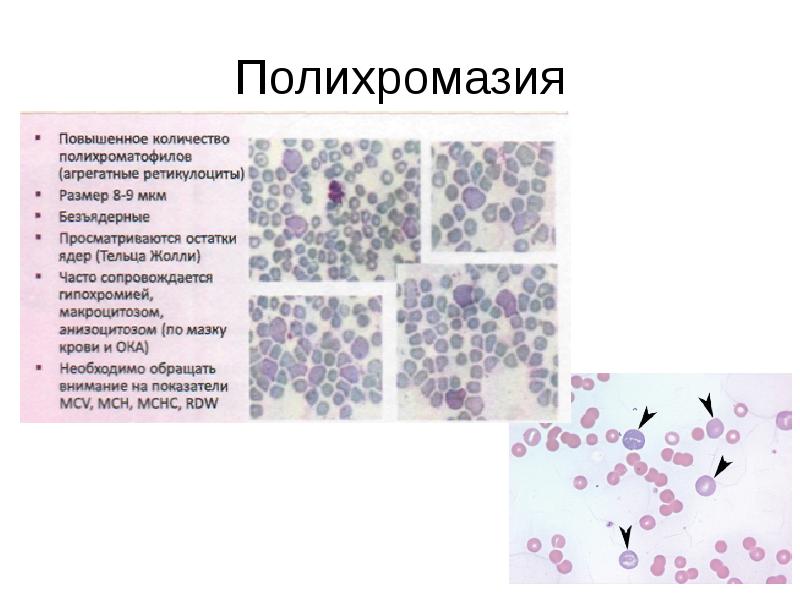 Полихромазия Полихромазия