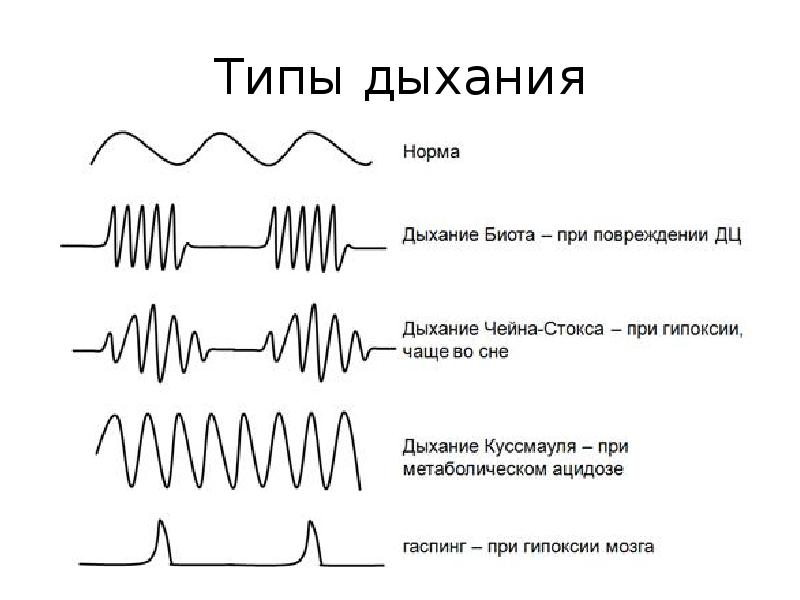 Ритм дыхания. Дыхание Биота Чейна Стокса Куссмауля. Типы дыхания Куссмауля Чейна Стокса Биота. Дыхание типа Чейна-Стокса. Дыхание Чейна Стокса дыхание Биота.