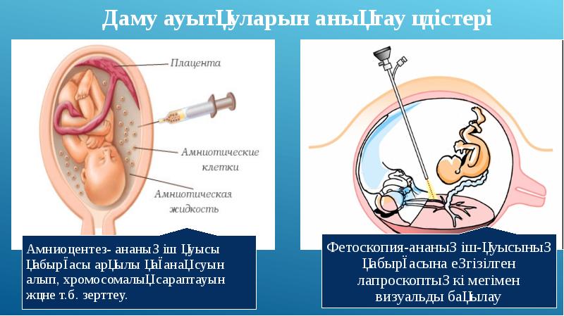 Жатыр ішілік даму кезеңдері презентация