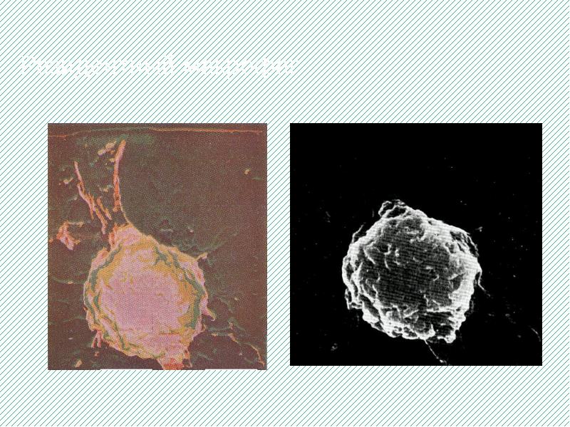 Резидентный макрофаг Резидентный макрофаг