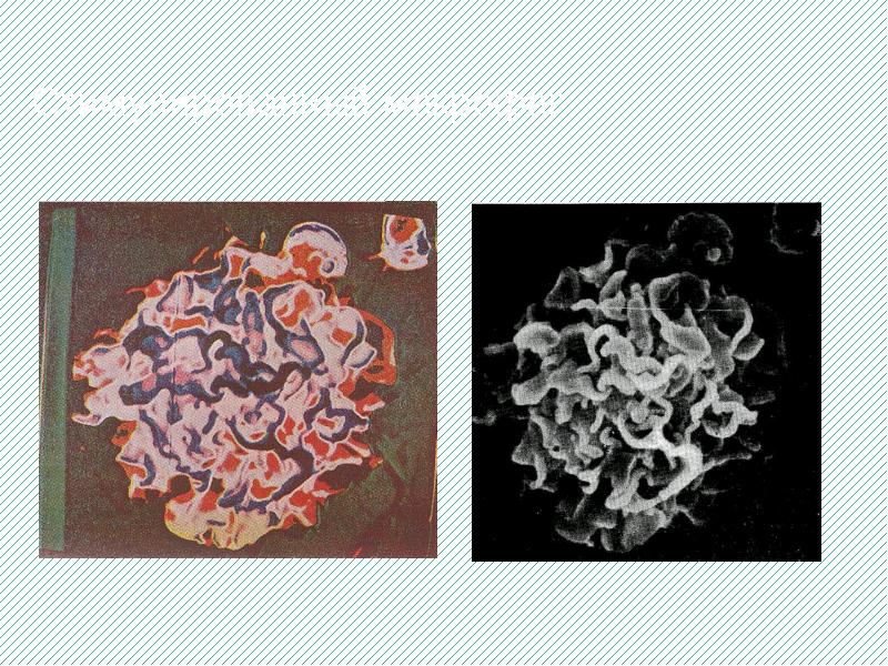 Стимулированный макрофаг Стимулированный макрофаг