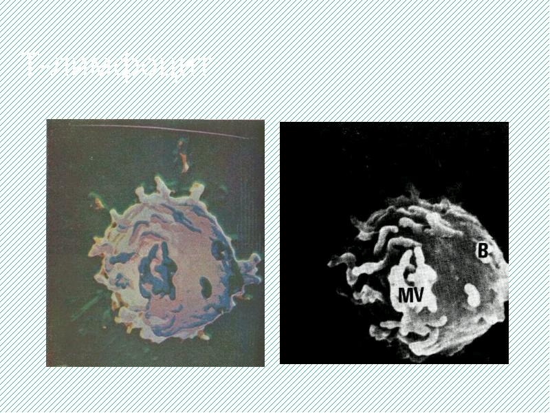 Т-лимфоцит Т-лимфоцит