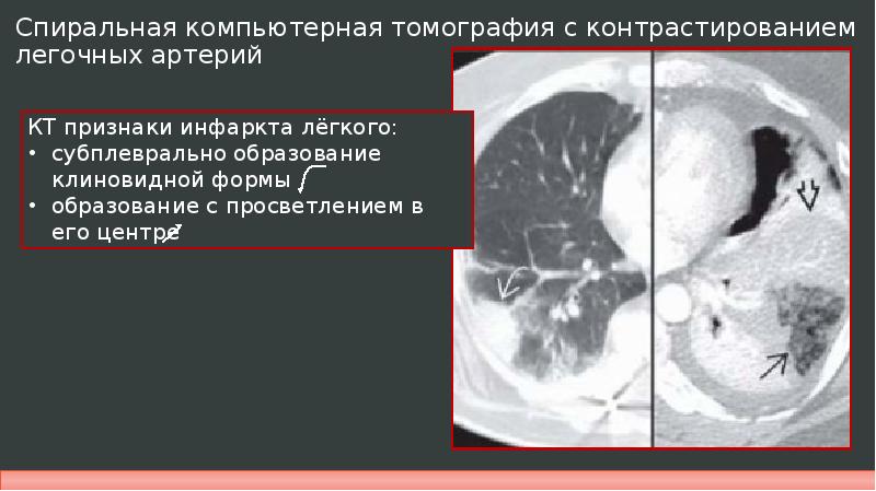 Презентация тэла по хирургии