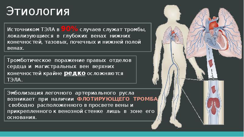 Тэла презентация хирургия