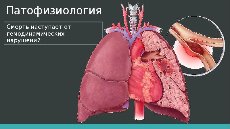 Тэла презентация хирургия