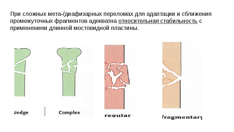 Абсолютная и относительная стабильность. Винты