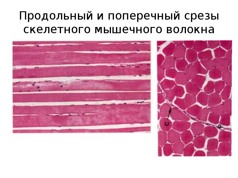 Поперечно полосатые мышечные волокна входят в состав стенок