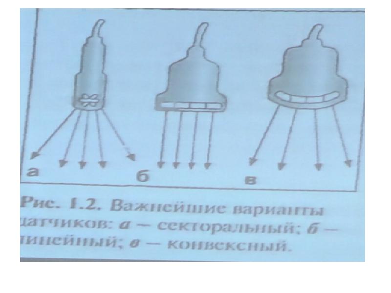 Ультразвуковое изображение серозоцеле представлено