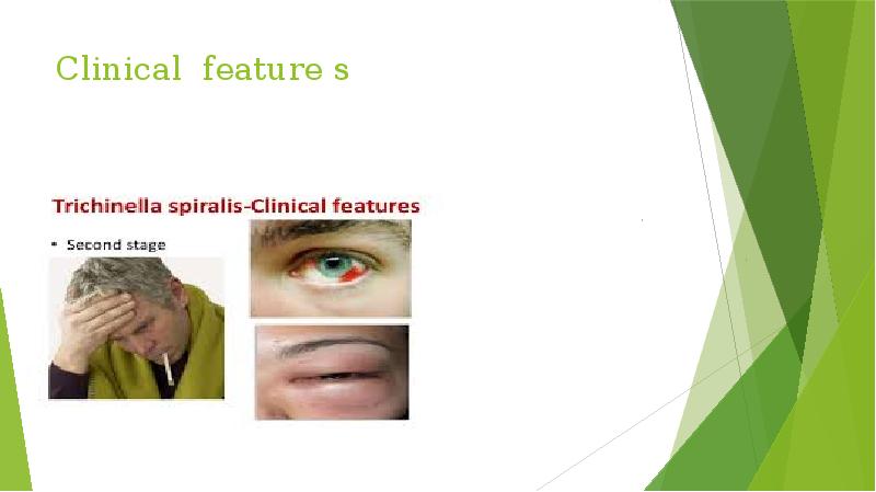 Clinical feature s