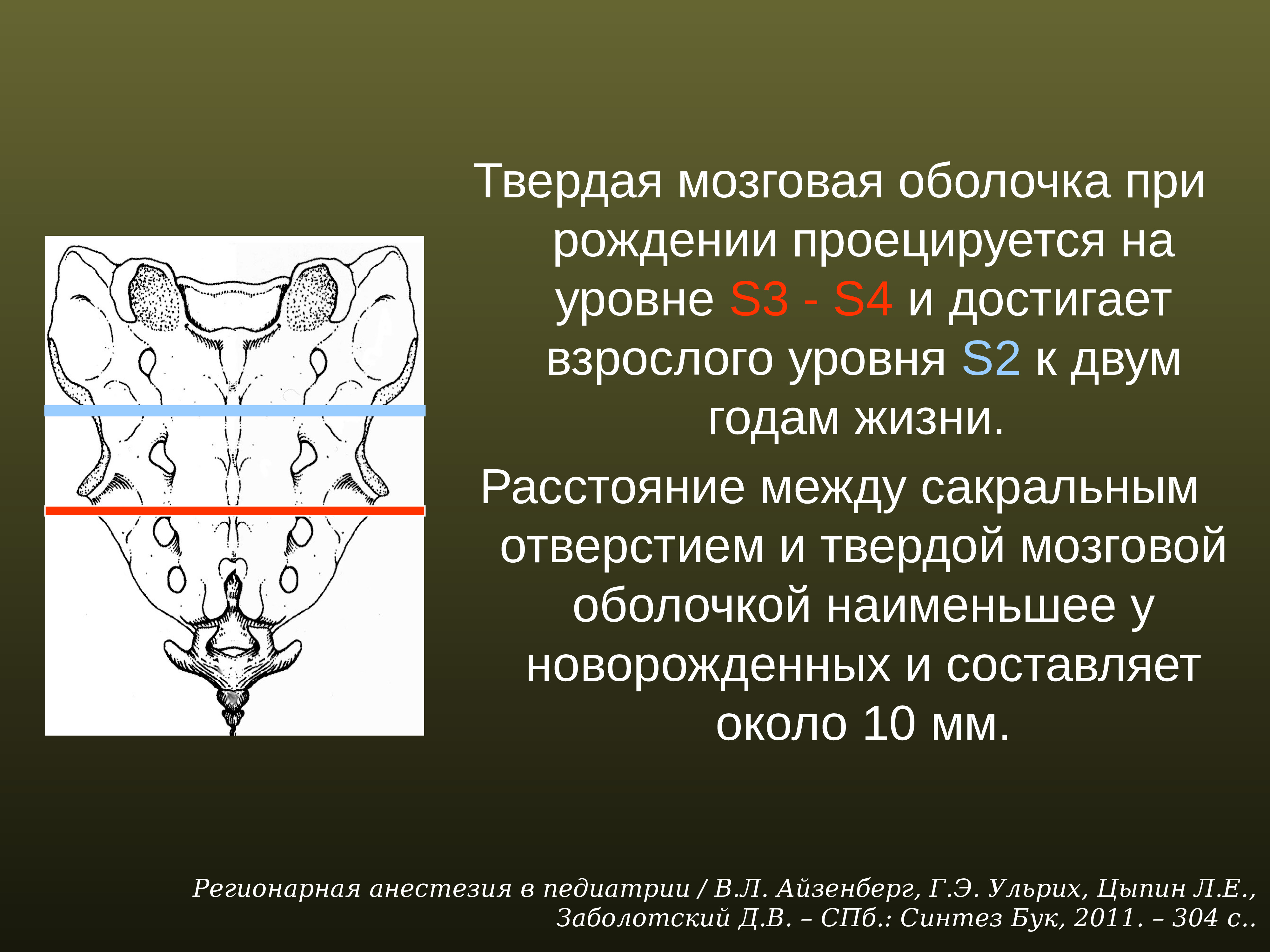 Регионарная анестезия у детей презентация