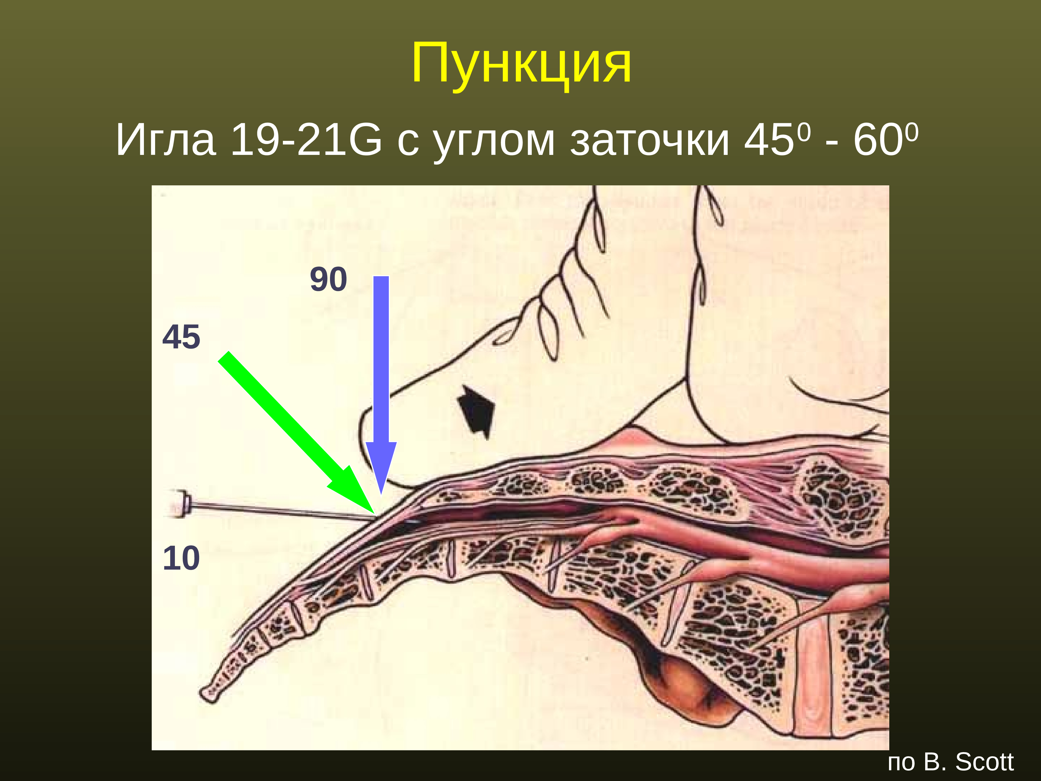 Регионарная анестезия у детей презентация