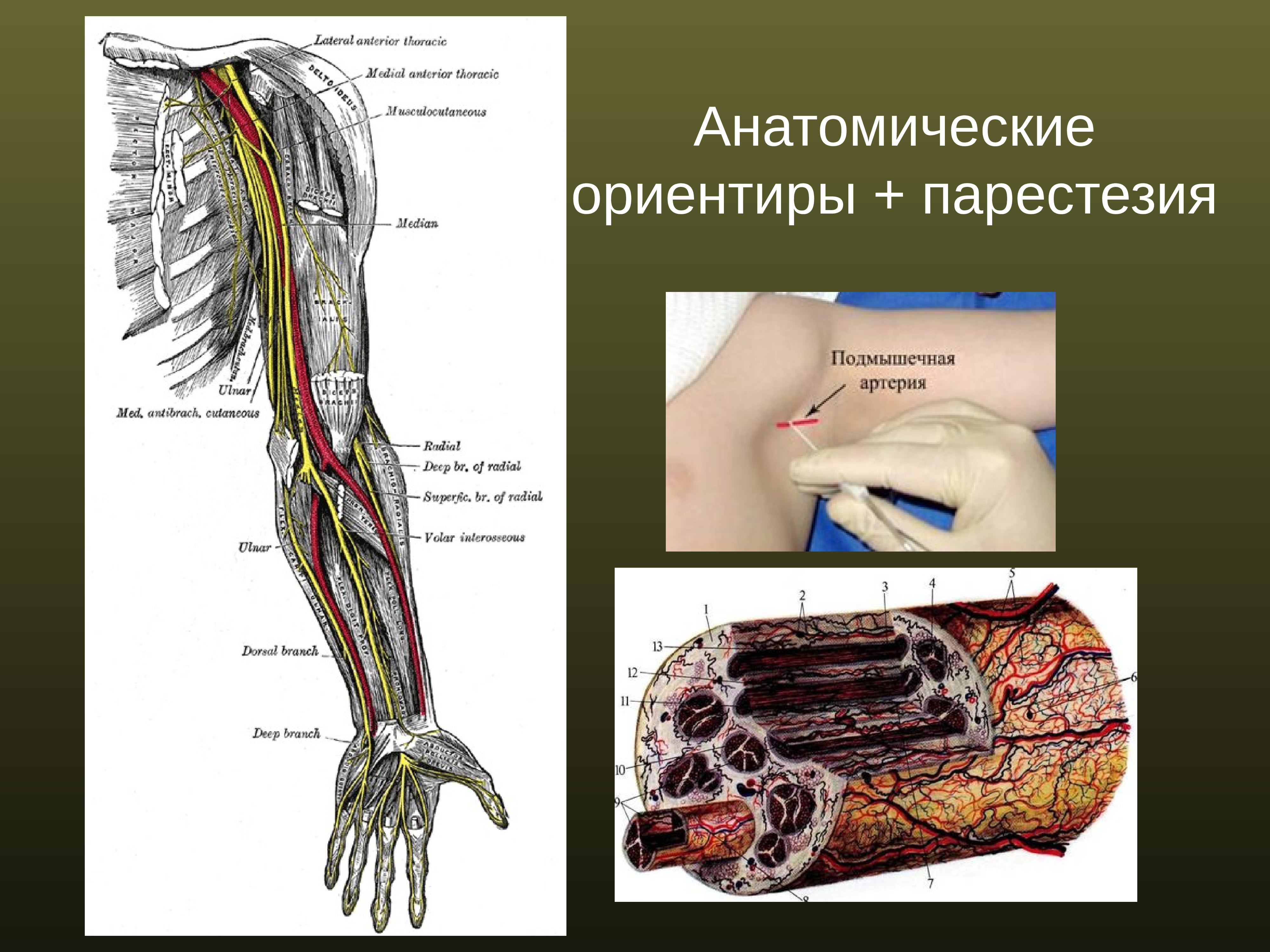 Парестезия анестезии. Анатомические ориентиры. Регионарная анестезия верхней конечности кисти. Регионарная анестезия верхней конечности.