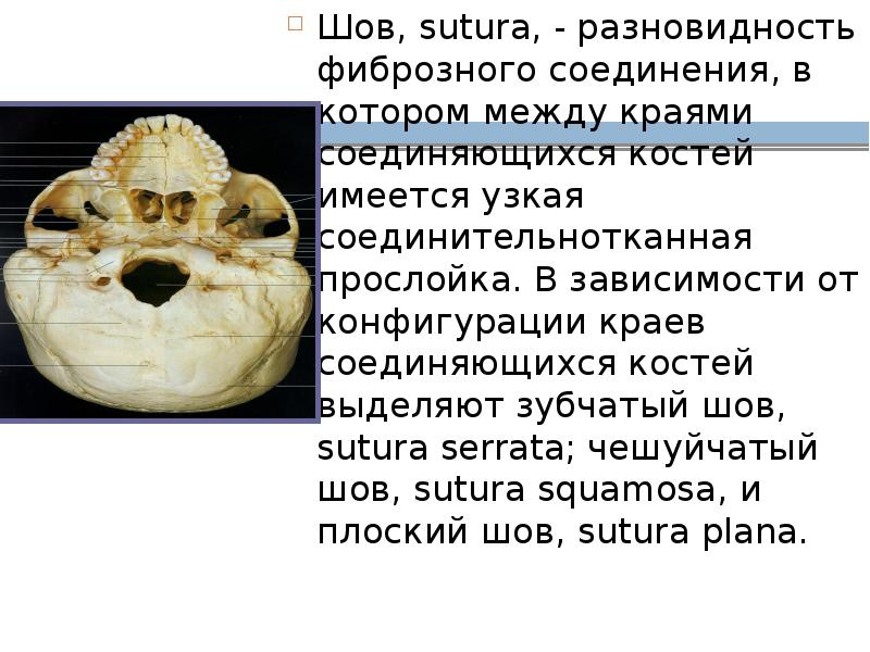 Шов, sutura, - разновидность фиброзного соединения, в котором между краями соединяющихся